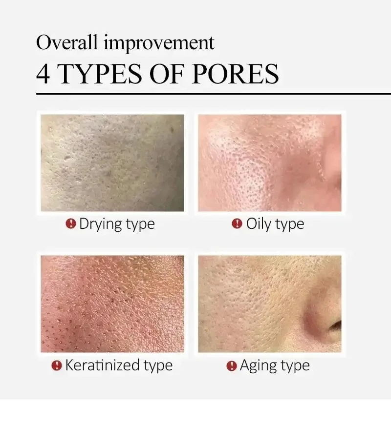 Sérum Visage Réducteur de Pore - Luxury Skincare Korea avis et prix
